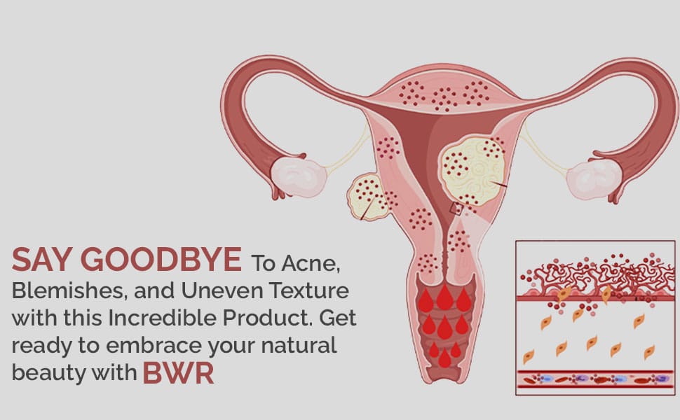 BWR - Termination of cancer (رسولی کا خاتمہ)